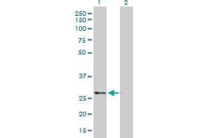 Western Blot analysis of PRKAB2 expression in transfected 293T cell line by PRKAB2 MaxPab polyclonal antibody. (PRKAB2 Antikörper  (AA 1-272))