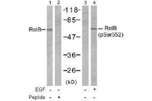 Image no. 1 for anti-V-Rel Reticuloendotheliosis Viral Oncogene Homolog B (RELB) (pSer552) antibody (ABIN197017) (RELB Antikörper  (pSer552))