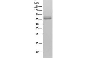 Western Blotting (WB) image for Pyruvate Kinase M2 (PKM2) (AA 1-531) protein (His tag) (ABIN7124723) (PKM2 Protein (AA 1-531) (His tag))