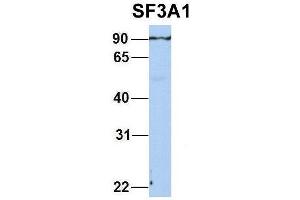 Host:  Rabbit  Target Name:  SF3A1  Sample Type:  Human Adult Placenta  Antibody Dilution:  1. (SF3A1 Antikörper  (N-Term))