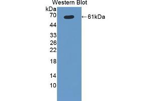 Detection of Recombinant CYP11B1, Rat using Polyclonal Antibody to Cytochrome P450 11B1 (CYP11B1) (CYP11B1 Antikörper  (AA 1-498))