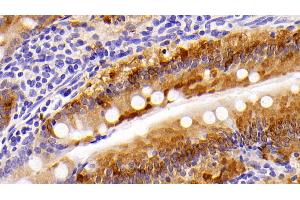 Immunohistochemistry (IHC) image for anti-Fatty Acid Binding Protein 1, Liver (FABP1) (AA 2-127) antibody (ABIN7433792)