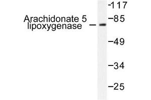 Image no. 1 for anti-Arachidonate 5-Lipoxygenase (ALOX5) antibody (ABIN271992) (ALOX5 Antikörper)