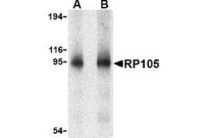 Western blot analysis of RP105 in human spleen tissue lysate with RP105 antibody at (A) 0. (CD180 Antikörper  (N-Term))