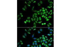 Immunofluorescence analysis of A-549 cells using ANGPTL4 Polyclonal Antibody (ANGPTL4 Antikörper)