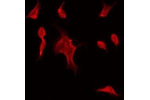 ABIN6275528 staining Hela by IF/ICC. (STK32C Antikörper  (Internal Region))
