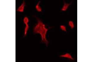 ABIN6275528 staining Hela by IF/ICC. (STK32C Antikörper  (Internal Region))