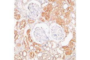 Immunohistochemical staining of human kidney tissue using XIAP polyclonal antibody  at 2 ug/mL .