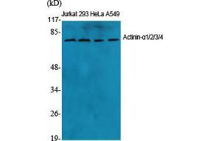 Western Blot (WB) analysis of specific cells using Actinin-alpha1/2/3/4 Polyclonal Antibody. (ACTN1/2/3/4 Antikörper  (N-Term))
