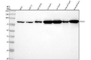 Western blot analysis of PFKM using anti-PFKM antibody (ABIN7604893).