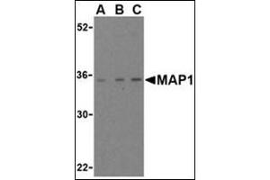 Western blot analysis of MAP-1 in EL4 cell lysate with this product at (A) 1, (B) 2, and (C) 4 μg/ml