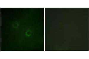 Immunofluorescence analysis of COS7 cells, using Lck (Ab-192) Antibody. (LCK Antikörper  (AA 161-210))