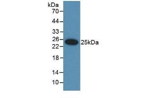 Detection of Recombinant UBD, Rat using Polyclonal Antibody to Ubiquitin D (UBD) (UBD Antikörper  (AA 1-155))