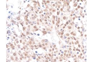 anti-Chromatin Assembly Factor 1, Subunit A (p150) (CHAF1A) (AA 500-550) antibody