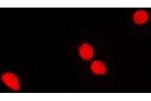 Immunofluorescent analysis of RNGTT staining in MCF7 cells. (RNGTT Antikörper)