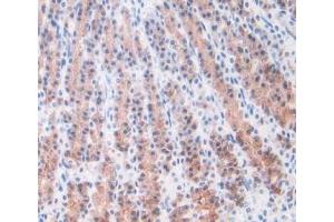 IHC-P analysis of Rat Stomach Tissue, with DAB staining. (ORM1 Antikörper  (AA 19-186))