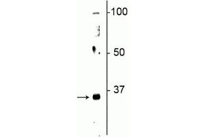Western blot of neonatal rat brain lysate showing specific immunolabeling of the ~32 kDa Olig2 protein. (OLIG2 Antikörper)