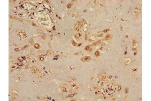 Immunohistochemistry of paraffin-embedded human placenta tissue using ABIN7171778 at dilution of 1:100 (TINF2 Antikörper  (AA 210-451))
