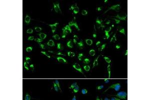 Immunofluorescence analysis of MCF-7 cells using CDKN3 Polyclonal Antibody (CDKN3 Antikörper)