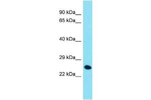Host: Rabbit  Target Name: Chmp4c  Sample Tissue: Mouse Liver lysates  Antibody Dilution: 1. (CHMP4C Antikörper  (C-Term))
