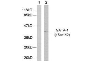Western blot analysis of extracts from K562 cells using GATA-1 (phospho-Ser142) antibody (E011041). (GATA1 Antikörper  (pSer142))
