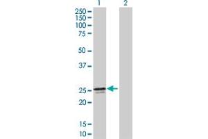 Western Blot analysis of MMACHC expression in transfected 293T cell line by MMACHC MaxPab polyclonal antibody.