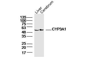 Lane 1: Rat Liver lysates Lane 2: Rat Cerebrum lysates probed with CYP3A1 Polyclonal Antibody, Unconjugated  at 1:300 dilution and 4˚C overnight incubation. (CYP3A1 Antikörper  (AA 231-330))