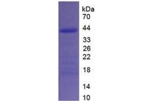 SDS-PAGE (SDS) image for Procollagen I N-Terminal Propeptide (PINP) ELISA Kit (ABIN6574243)