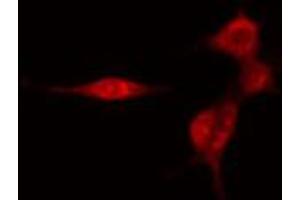 ABIN6274453 staining HeLa cells by IF/ICC. (SMG7 Antikörper  (Internal Region))