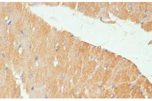Immunohistochemistry of paraffin-embedded Mouse heart using MYBPC3 Polyclonal Antibody at dilution of 1:100 (40x lens). (MYBPC3 Antikörper)