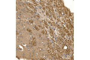 IHC analysis of Paxillin/PXN using anti-Paxillin/PXN antibody (ABIN7602636). (Paxillin Antikörper  (AA 9-570))