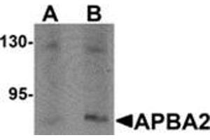 Western blot analysis of APBA2 in human brain tissue lysate with APBA2 antibody at (A) 1 and (B) 2 μg/ml. (APBA2 Antikörper  (Center))