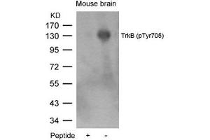 Western blot analysis of extracts from mouse brain tissue using TrkB(Phospho-Tyr705) Antibody and the same antibody preincubated with blocking peptide.