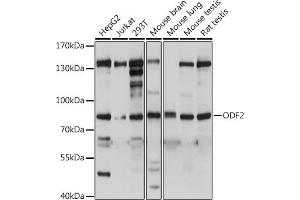 Western blot analysis of extracts of various cell lines, using ODF2 antibody (ABIN7269128) at dilution. (ODF2 Antikörper  (AA 630-829))