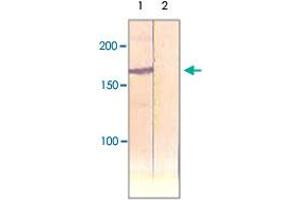 The cell lysate derived from insulin stimulated CHO was immunoprecipitated by IRS1 polyclonal antibody , then immunoprobed by the same antibody at 1 : 500 (Lane 1). (IRS1 Antikörper)