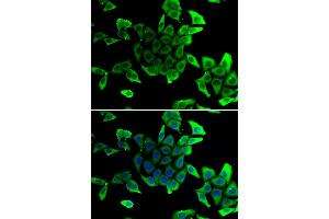 Immunofluorescence analysis of U2OS cells using SGCD antibody (ABIN6292039). (SGCD Antikörper)