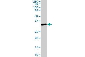 MEOX2 monoclonal antibody (M08), clone 5E1. (MEOX2 Antikörper  (AA 1-303))