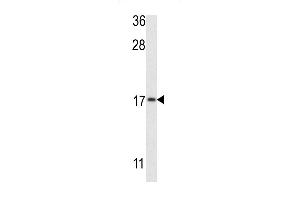 Western blot analysis of G8b (M1LC3B) Antibody (T93/Y99) 1802e in MCF-7 cell line lysates (35 μg/lane).