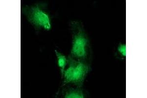 Anti-BEST3 mouse monoclonal antibody (ABIN2453917) immunofluorescent staining of COS7 cells transiently transfected by pCMV6-ENTRY BEST3 (RC218436). (Bestrophin 3 Antikörper)