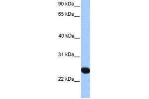 WB Suggested Anti-CSGlcA-T Antibody Titration:  0. (CHPF2 Antikörper  (N-Term))