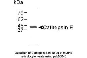 Image no. 1 for anti-Cathepsin E (CTSE) (C-Term) antibody (ABIN363354) (Cathepsin E Antikörper  (C-Term))