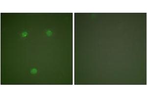 Immunofluorescence analysis of COS7 cells, using GADD153 Antibody. (DDIT3 Antikörper  (AA 91-140))