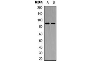Western blot analysis of FGFR4 expression in HEK293T (A), PC12 (B) whole cell lysates. (FGFR4 Antikörper  (C-Term))