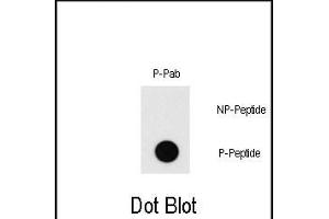 Dot blot analysis of Phospho-MEF2C-T20 Pab (Cat. (MEF2C Antikörper  (pThr20))