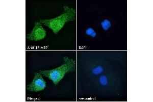 ABIN184830 Immunofluorescence analysis of paraformaldehyde fixed HeLa cells, permeabilized with 0.