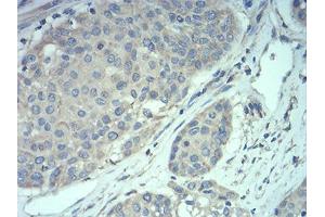 Immunohistochemistry (IHC) image for anti-Methyl CpG Binding Protein 2 (MECP2) (AA 7-148) antibody (ABIN5889789) (MECP2 Antikörper  (AA 7-148))