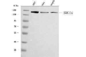 Western blot analysis of SMC1A using anti-SMC1A antibody (ABIN7602089).