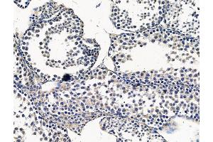 ABIN7096380 and ABIN7100444 at 1/100 staining mouse testis tissue by IHC-P. (PMPCA Antikörper)