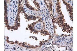 Image no. 10 for anti-Destrin (Actin Depolymerizing Factor) (DSTN) antibody (ABIN1497910) (Destrin Antikörper)