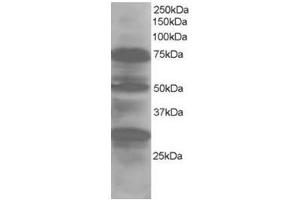 Image no. 1 for anti-LIM Domain 7 (LMO7) (Internal Region) antibody (ABIN374384) (LMO7 Antikörper  (Internal Region))